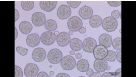 Differentiation of hPSCs to Ventricular Cardiomyocytes in 3D Culture