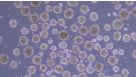 How to Differentiate hPSCs to Lymphoid-Competent CD34+ Hematopoietic Stem and/or Progenitor Cells Using a Scalable Suspension Protocol