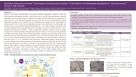 Workflow Solutions for Human T Cell Isolation and Expansion