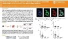 Modelling Pancreatic Cancer Through Pancreatic Exocrine Organoids Using PancreaCult™ Serum-free Medium