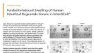 Forskolin-Induced Swelling of Human Intestinal Organoids Grown in IntestiCult™