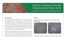 Culture Adipose-Derived Mesenchymal Stem Cells in Serum-Free, Xeno-Free MesenCult™-XF
