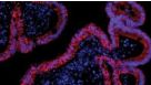 Mouse Intestinal Organoid Course