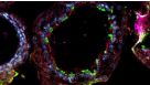 FAQs on Human Airway Organoid Cultures