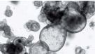 Frequently Asked Questions on STEMdiff™ Intestinal Organoid Kit