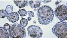 Enumerating Mammospheres and Tumorspheres from Cells Cultured in MammoCult™ Medium