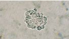 NeuroCult&trade; Neural Colony-Forming Cell (NCFC) Assay