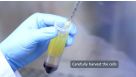 How to Isolate PBMCs from Whole Blood Using Density Gradient Centrifugation (Ficoll™ or Lymphoprep™)
