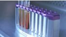 Cell Isolation Directly from Whole Blood without RBC Lysis or Centrifugation: EasySep™ Direct
