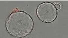 Growth of Mouse Pancreatic Organoids in PancreaCult™ Culture Medium: Under a Microscope