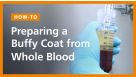 How to Prepare a Buffy Coat from Whole Blood