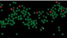 Cell Separation Solutions for HLA and Chimerism Analysis