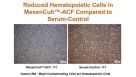 A Novel, Animal Component-Free (ACF) Culture System for Efficient Isolation, Expansion and Cryopreservation of Human MSCs