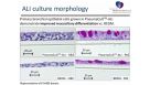 PneumaCult™-ALI: An Improved Medium Formulation for the Differentiation of Human Bronchial Epithelial Cells