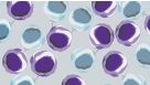 Fast and Versatile Isolation of Distinct Human Regulatory T Cell Subsets