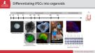 iPSCs As Models, Part 2: Modeling the Human Brain with Organoids